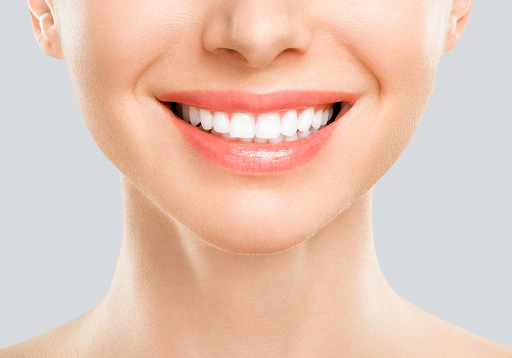 ホワイトニング